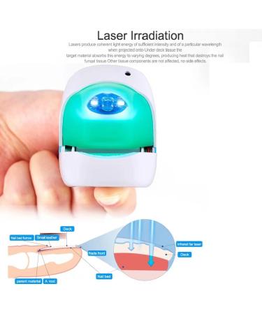 ATANG Touch Screen Nail Fungus Treatment & Cleaning Device with Timer Portable Rechargeable Fast Painless Laser Therapy Instrument for Fingernails and Toenails (White) - Buy Online on GoSupps.com