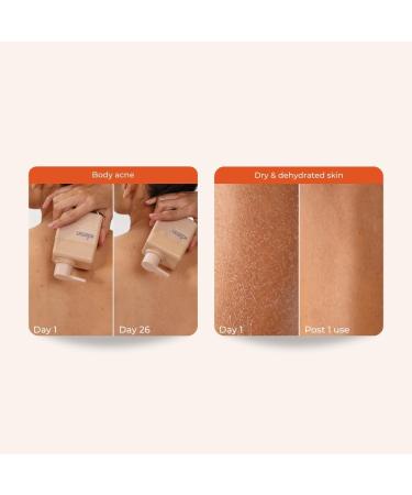 Smoothie-in Shower Body Conditioner 30 Fl Oz - Nourishing Hydration for All Skin Types | International Shipping Available - Buy Online on GoSupps.com