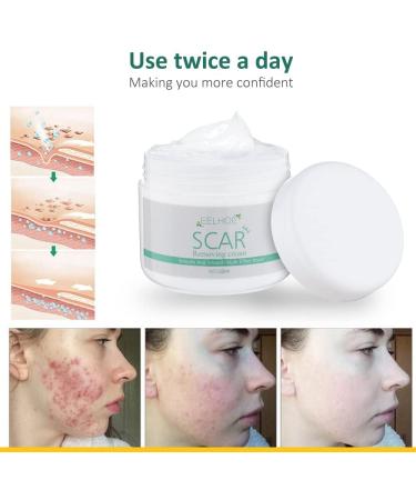30g Scar Repair Cream | Reduces Stretch Marks, Burns & Acne Scars | Skin Smoothing Treatment - Buy Online on GoSupps.com