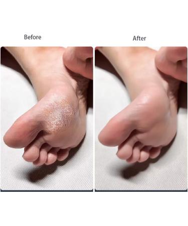 4-Piece Double Sided Foot File Set | Callus Remover & Scrubber for Smooth Feet | Pedicure Tools for Dead Skin Removal - Worldwide Shipping - Buy Online on GoSupps.com