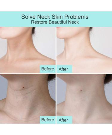 Symmea's Neck Scooter - 2-in-1 Anti-Aging Firming Cream & Massage for Neck Tightening Wrinkle Reduction & Moisturization - Buy Online on GoSupps.com