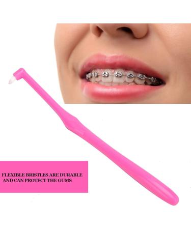 Ververt Touch Dnichs Orthodontic Toothbrush Set - 3-Pack Small Head Tooth Cleaning Brushes - Pink - Ideal for Effective Oral Care - Buy Online on GoSupps.com