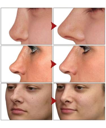 Liftx Nose Defining Serum Sci-Effect Nose Lift Shaping Oil Nose Lift Up Shaping Essence Oil Nasal Bone Remodeling Serum Remodeling Contouring Oil Serum (1 Pcs) - Buy Online on GoSupps.com