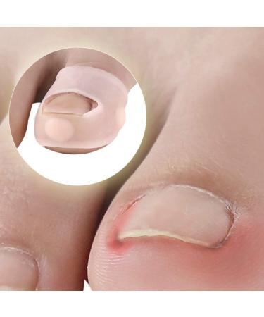 Supvox Toe Nail Correction Patch - 3 Pairs Gel Smoothing Stickers for Pedicure & Protection - Effective Nail Treatment for Adults & Students - Buy Online on GoSupps.com