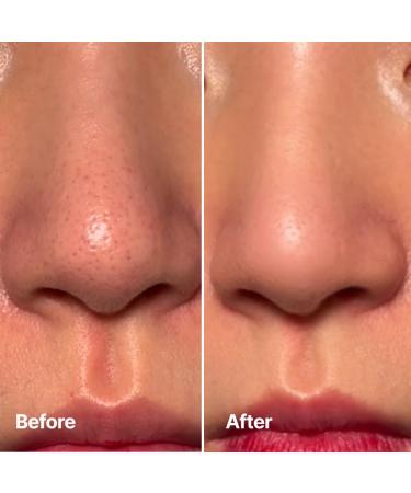 ChungMiJung Aloe Fermentation Cleansing Oil Hydrating and Gentle Cleanser Makeup Blackhead Remover Olea Europaea (Olive) Fruit Oil All Skin Types Korean Skin Care 6.7 fl.oz. / 200ml - Buy Online on GoSupps.com