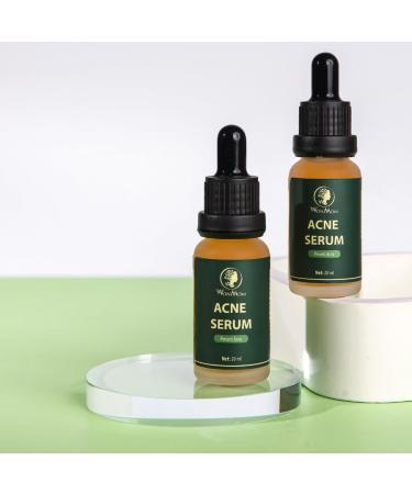 Buy Acne Serum (0.7 fl oz) | Fast International Shipping & Clear Skin Solution - Buy Online on GoSupps.com