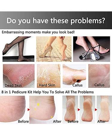 21-in-1 Professional Pedicure Set - Stainless Steel Foot Care Kit for Cornea Removal & Foot Health - Buy Online on GoSupps.com