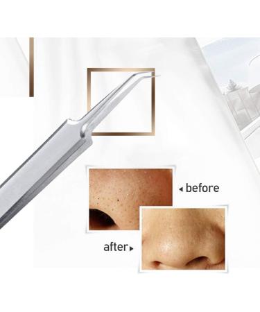 Blackhead Tweezers - Professional Stainless Steel Tool for Pimple Removal & Blackhead Extraction - Buy Online on GoSupps.com