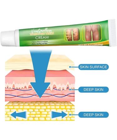 3PCS Venue Smoothing Cream for Varicose Veins - Soothing & Circulation-Boosting Leg Cream - Eliminate Spider Veins - 20g - Buy Online on GoSupps.com
