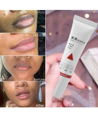 Lip Balm for Dark Lips Fresh Pink Lip Balm Whitening Cream Lip Balm for Smokers Lip Balm for Men and Women 15ml (1pcs) - Buy Online on GoSupps.com