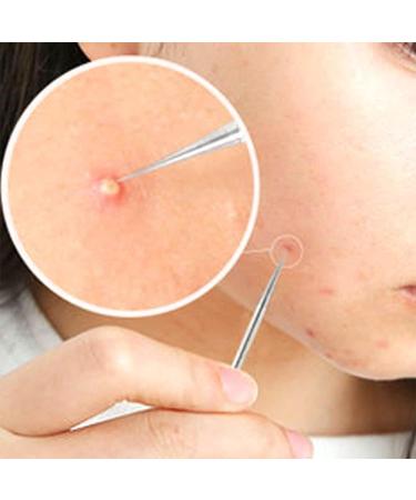 PiurUf Acne Needle Set - 4Pcs Stainless Steel Pimple Remover Tool for Effective Face Care - Ship Internationally - Buy Online on GoSupps.com
