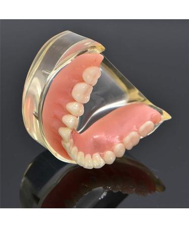 Dental Model Overdenture with 4 Implants - Ideal for Teaching Toothbrushing & Hygiene in Classes - International Shipping Available - Buy Online on GoSupps.com