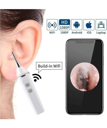 Marycan 3.9mm WiFi Ear Wax Removal Endoscope 5MP 1920P FHD Camera - Portable Visual Ear Cleaner Tool for Adults, Kids & Pets (Black) - Buy Online on GoSupps.com