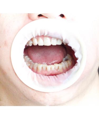 26Pcs Disposable Elastic Lips and Cheeks Mouth Opener for Teeth Whitening Orthodontic Retractor - Buy Online on GoSupps.com