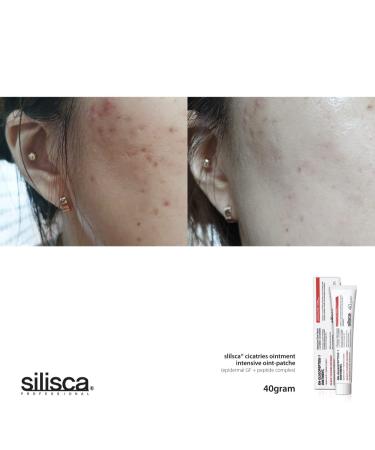 Silisca Cicatries Ointment - Healing wounds with optimal moisture protection - 1.41 fl.oz (40 g) - Buy Online on GoSupps.com