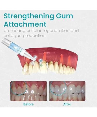 Neslemy Gum Therapy Gel - Advanced Gum Shield Therapy Gel (4 Pack 4ml) for Optimal Oral Health - International Shipping Available - Buy Online on GoSupps.com