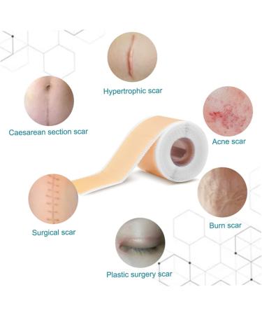 Healvian Silicone Gel Scar Patch Stickers - Skin Recovery Tape for Surgery - 1 Roll - Buy Online on GoSupps.com