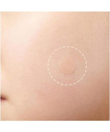 36 Acne Pimple Spot Zit Patches Face Treatment Stickers Pimple Cover Invisible Hydrocolloid Absorbing Cover Up Covering Healing Patch for Concealer Blemish Care + Free Blackhead Zit Remover Tool - Buy Online on GoSupps.com