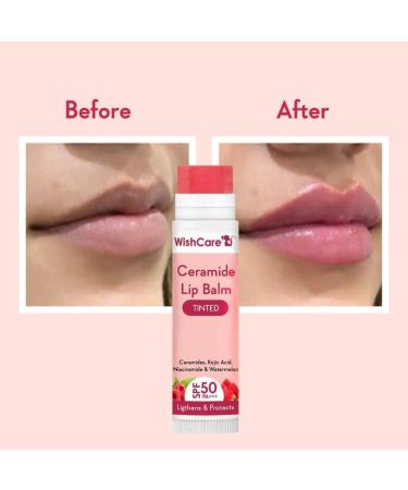 Buy wish_care Tinted Ceramide Lip Balm with Niacinamide - Lip Lightening & Protection (5g) | Best International Shipping - Buy Online on GoSupps.com
