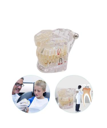 Buy Youya Transparent Dental Tooth Model for Dentists | Removable Pathological Teaching Model | International Shipping Available - Buy Online on GoSupps.com