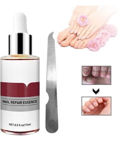 1PC Nail Treatment Nail Renewal Solution Toenails & Fingernails Nail Repairs Essential Oil Protects From Discoloration Brittle And Cracked Nail(12ML) nail fungus - Buy Online on GoSupps.com