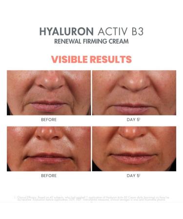 Buy Avene Eau Thermale Hyaluron Activ B3 Renewal Firming Cream Hydrating Anti-Aging Moisturizer for All Skin Types | International Shipping - Buy Online on GoSupps.com