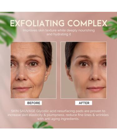 Glycolic Acid Resurfacing Pads for Face & Body - Smooth Skin Reduce Wrinkles Radiant Complexion | Shop Now - Buy Online on GoSupps.com