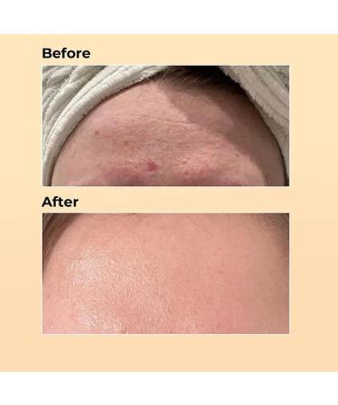 Advanced Snail Mucin 96% Repairing Essence - Hydrating Serum for Dull Skin & Fine Lines | Korean Beauty Skincare 100ml - Buy Online on GoSupps.com