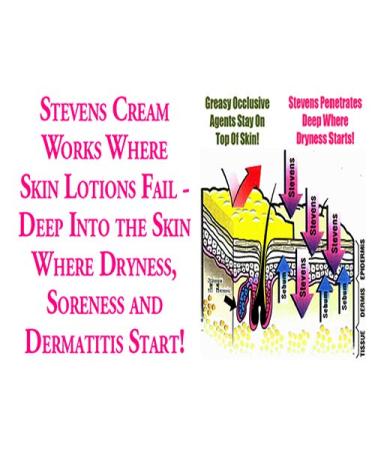 Stevens Moisturizing Skin Cream 8oz - Relieves Eczema, Psoriasis, Dry Skin - Fragrance Free - Buy Online on GoSupps.com