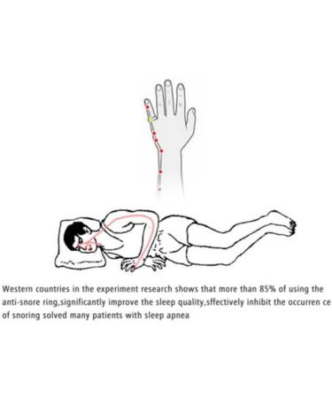 Acupressure Anti Snoring Ring XL - Relief for Snoring and Nasal Congestion - Buy Online on GoSupps.com