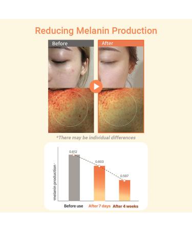 HEIMISH RX Multi Vitamin Dark Spot Cream - Brightening Cream for Dark Spot & Hyperpigmentation Reduction, Face Moisturizer, Hydrating, Anti Aging with Vitamin C, Niacinamide 5%, 50ml (1.69 fl. oz) - Buy Online on GoSupps.com