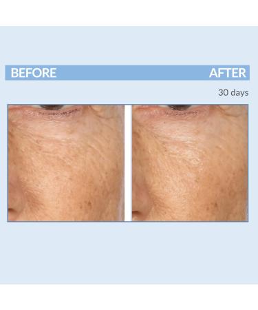 Retinol Fine Lines and Wrinkles Skin Care Set - A Force XR Serum and A Cream XR Moisture Cream for Face - Anti-Aging - Minimize Post Acne Marks - Resurface and Hydrate - Serious Skincare - Buy Online on GoSupps.com