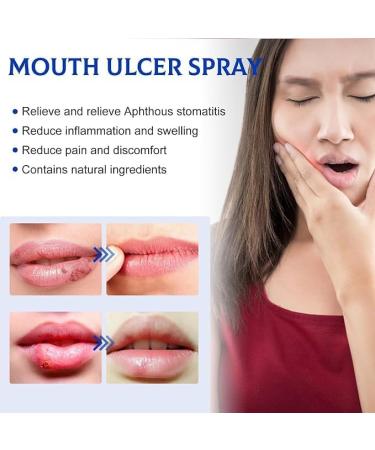 Oral Relief Spray - Canker & Dry Mouth Relief | Moisturizing Oral Care Spray - Buy Online on GoSupps.com