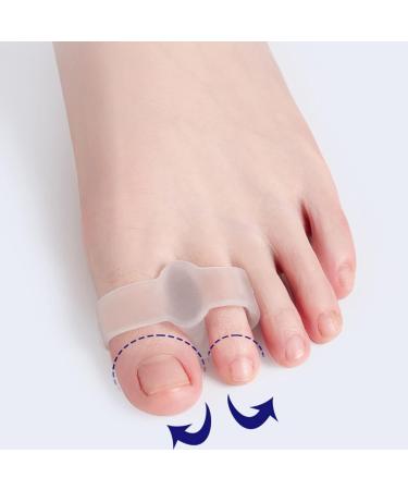 Gel Metatarsal Pad for Bunions - Pain Relief & Toe Alignment - Correct Crooked Toes & Overlap - Hallux Valgus Support - Buy Online on GoSupps.com