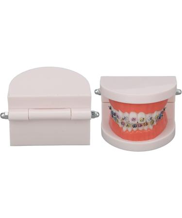 Orthodontic Tooth Model with Metal Brackets - Ideal for Teaching & Research in Laboratories | International Shipping - Buy Online on GoSupps.com
