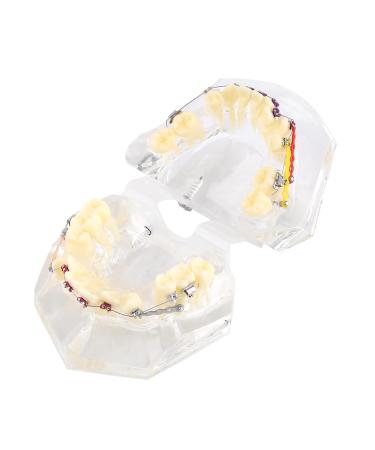 Tooth Model for Dentists & Orthodontists | Dental Orthodontic Study Model with Wire Chain for Painting Treatment - Buy Online on GoSupps.com