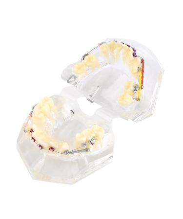 Premium Dental Orthodontic Malocclusion Correction Kit | Standard Teeth Model & Wire Chain for Kids Students & Patients - Precise Alignment & Treatment - Buy Online on GoSupps.com