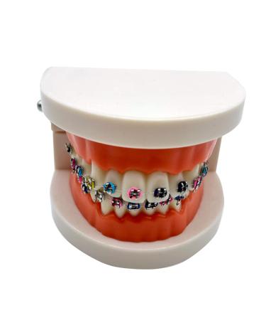 Dental Orthodontic Model with Metal Brackets and Arch Wire - Standard Teeth Model with Braces for Demonstration - Buy Online on GoSupps.com