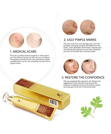 Scar Removal Cream for Old Scars & Stretch Marks Relief - Men & Women Face Skin Repair Gel - Buy Online on GoSupps.com