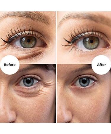 Gle Eye Serum for Dark Circles, Eye Wrinkles & Redness - with Caffeine, Vitamin C & Hyaluronic Acid - Buy Online on GoSupps.com