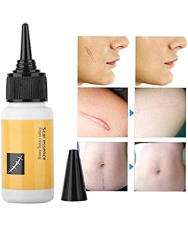 Delicate Skin Scar Treatment Serum - Acne Scar Removal & Repair Cream - 20ml - Buy Online on GoSupps.com