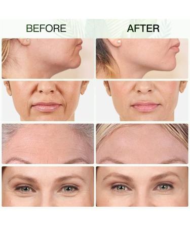 Premium Gua Sha Face Massager - Lymphatic Drainage & Facial Sculpting Tool | Wildling Gua Sha Stone - Buy Online on GoSupps.com