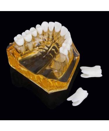 LBYLYH Adult Tooth Replica Model - Medical Dental Teaching Tool for Professionals - International Shipping Available - Buy Online on GoSupps.com