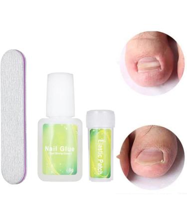 Ingrown Toenail Correction Kit Elastic Toe Nail Straightener Patch with Nail File Glue - Buy Online on GoSupps.com