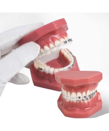 Orthodontic Dental Teeth Model with Metallic & Ceramic Brackets - Ideal for Dentist Patient Communication | Gylejwh - Buy Online on GoSupps.com