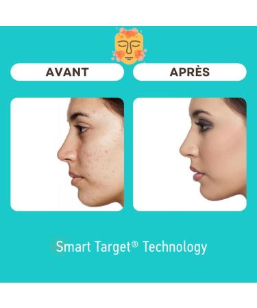 beMe SOS Fast Acne Gel 15 ml - Colorless gel with concentrated formula - Dries and eliminates pimples - Protects with probiotics - Beats acne! - Buy Online on GoSupps.com