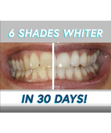 Smileactives Teeth Whitening Gel - 2.0oz | Whitens Teeth 6 Shades in 7 Days* | Long-Lasting Stain Removal | Use with Toothpaste | Clinical-Grade Formula (2 Ounce) - Buy Online on GoSupps.com
