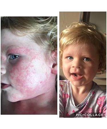 Bria 100% Natural Organic Soothing Balm for Eczema, Dry Skin - 120ml | Adults, Children & Babies | Scent-Free - Buy Online on GoSupps.com