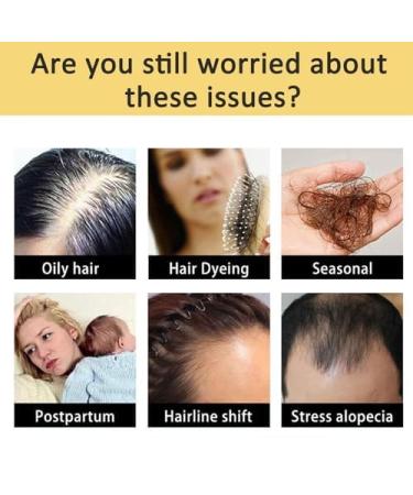 SADOER Ginger Hair Growth Oil - Plant-Powered Serum for Stronger Thicker Hair | Anti-Hair Loss Solution for Women & Men (3 Pack - Buy Online on GoSupps.com