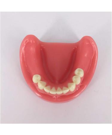 Fhuili Dental Lower Jaw Teeth Missing Model - 9 Teeth Oral Simulation for Study - Realistic Gum Dental Demo - Buy Online on GoSupps.com